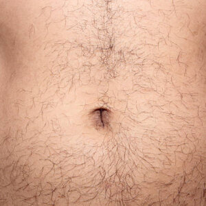 Solution-Clinic-Laser Hair removal-Belly-Man