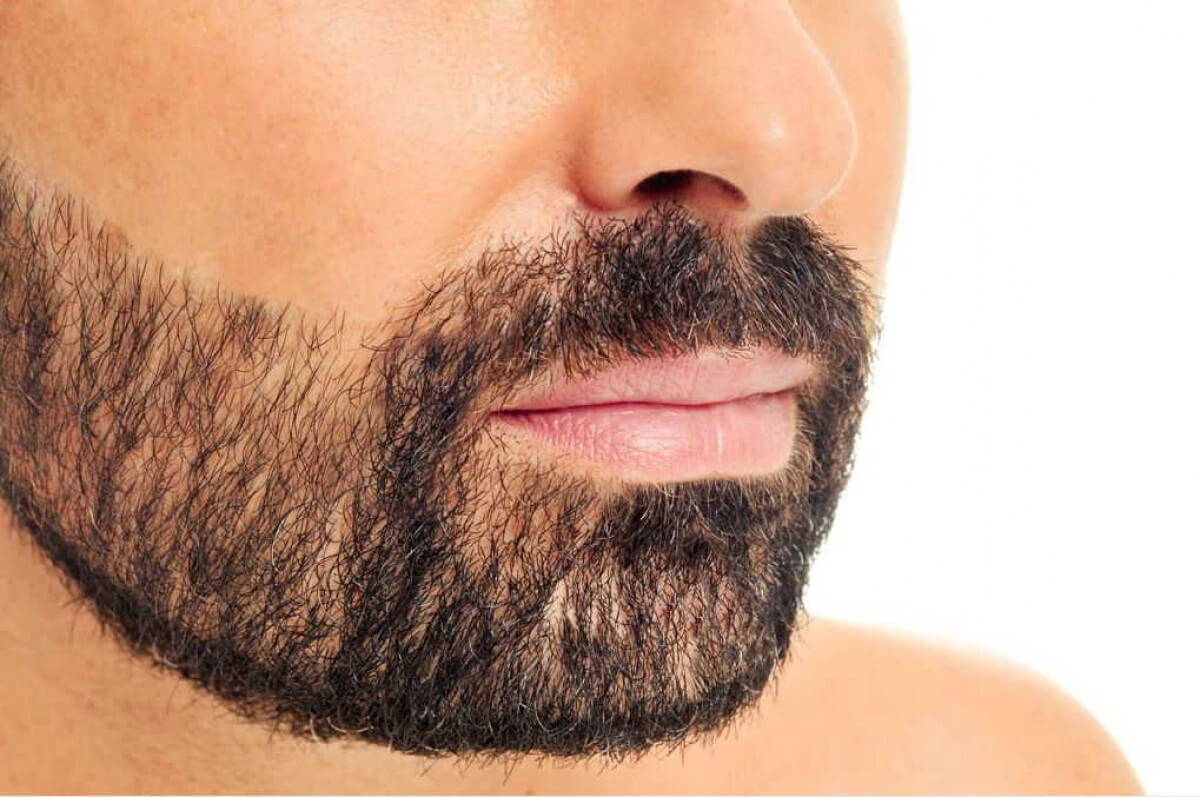 Facial hair removal | Men | Solution Clinic