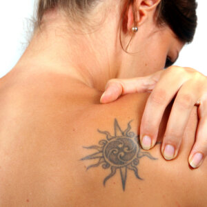 solution-clinic tattoo-removal-laser