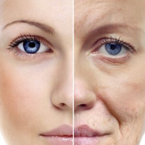 Solution-Clinic-Laser-Wrinkles